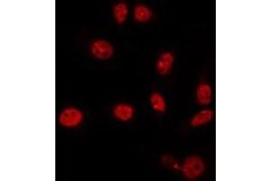 ABIN6266867 staining NIH-3T3 by IF/ICC. (HEXIM1 antibody)