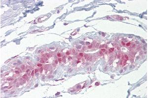 Immunohistochemistry with Breast tissue at an antibody concentration of 5µg/ml using anti-Ehf antibody (ARP36843_P050) (EHF antibody  (Middle Region))