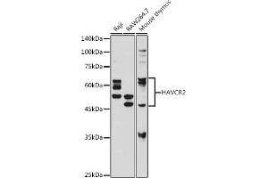 Western blot analysis of extracts of various cell lines, using TIM-3/H antibody (ABIN7267618) at 1:1000 dilution. (TIM3 antibody)