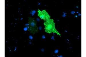 Anti-TULP3 mouse monoclonal antibody (ABIN2455453) immunofluorescent staining of COS7 cells transiently transfected by pCMV6-ENTRY TULP3 (RC207595). (TULP3 antibody)