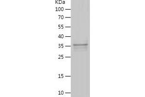 Western Blotting (WB) image for Scm-Like with Four Mbt Domains 2 (SFMBT2) (AA 2-93) protein (His-IF2DI Tag) (ABIN7282786) (SFMBT2 Protein (AA 2-93) (His-IF2DI Tag))