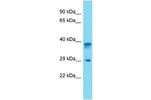 Western Blotting (WB) image for anti-Prion Protein (PRNP) (Middle Region) antibody (ABIN2789398) (PRNP antibody  (Middle Region))