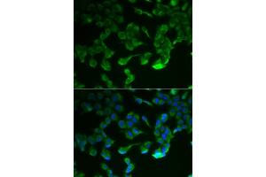 Immunofluorescence analysis of HeLa cells using C1R antibody (ABIN6129284, ABIN6137761, ABIN6137762 and ABIN6221975). (C1R antibody  (AA 466-705))