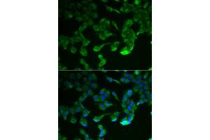 Immunofluorescence analysis of HeLa cells using C1R antibody (ABIN6129284, ABIN6137761, ABIN6137762 and ABIN6221975). (C1R antibody  (AA 466-705))