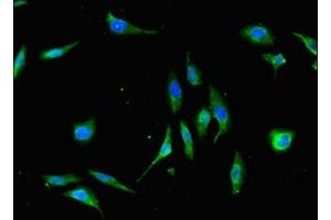 Immunofluorescent analysis of Hela cells using ABIN7175883 at dilution of 1:100 and Alexa Fluor 488-congugated AffiniPure Goat Anti-Rabbit IgG(H+L) (XBP1 antibody  (AA 1-167))