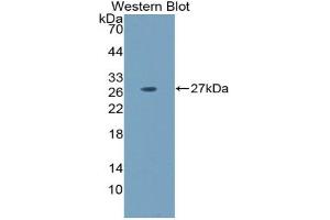 Detection of Recombinant LAMa5, Mouse using Polyclonal Antibody to Laminin Alpha 5 (LAMa5) (Laminin alpha 5 antibody  (AA 3517-3718))
