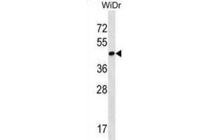 Western Blotting (WB) image for anti-THAP Domain Containing 11 (THAP11) antibody (ABIN2998587) (THAP11 antibody)