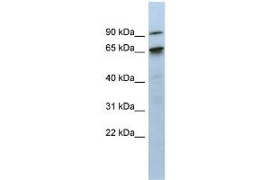 CTIF/KIAA0427 antibody  (N-Term)