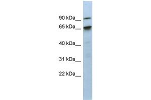 CTIF/KIAA0427 Antikörper  (N-Term)