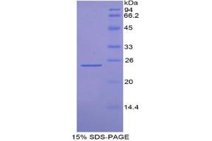 SDS-PAGE analysis of Mouse FDFT1 Protein.