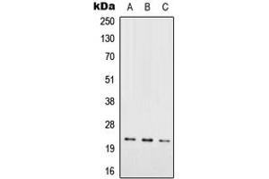 Western blot analysis of RAB7L1 expression in HEK293T (A), SP2/0 (B), PC12 (C) whole cell lysates. (RAB7L1 antibody  (Center))