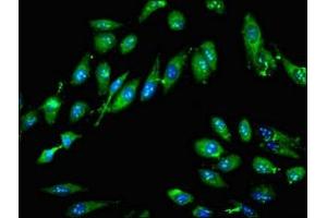 Immunofluorescent analysis of Hela cells using ABIN7161958 at dilution of 1:100 and Alexa Fluor 488-congugated AffiniPure Goat Anti-Rabbit IgG(H+L) (GTPBP4 antibody  (AA 347-634))