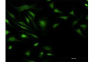 Immunofluorescence of monoclonal antibody to ZNF274 on HeLa cell. (ZNF274 antibody  (AA 420-530))