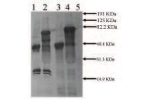 Rabbit anti Mouse tPA (2ug/ml) Secondary:  anti Rabbit IgG ABC Kit Lane 1:  0. (PLAT antibody)