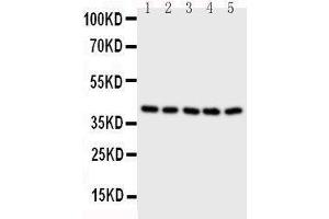 Western Blotting (WB) image for anti-Branched Chain Amino-Acid Transaminase 2, Mitochondrial (BCAT2) (AA 377-392), (C-Term) antibody (ABIN3043181)