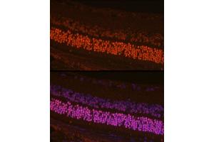 Immunofluorescence analysis of mouse retina cells using CRX Rabbit pAb (ABIN6130142, ABIN6139059, ABIN6139060 and ABIN6221382) at dilution of 1:200 (40x lens). (CRX antibody  (AA 120-285))