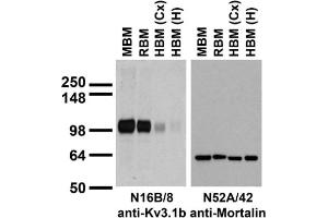 anti-Potassium Voltage-Gated Channel, Shaw-Related Subfamily, Member 1 (KCNC1) (AA 437-585), (C-Term), (Cytosolic) antibody