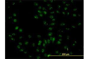 Immunofluorescence of purified MaxPab antibody to NOP56 on HeLa cell. (NOP56 antibody  (AA 49-174))