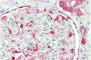 Immunohistochemistry (IHC) image for anti-NAD(P)H Dehydrogenase, Quinone 1 (NQO1) (C-Term) antibody (ABIN184714)