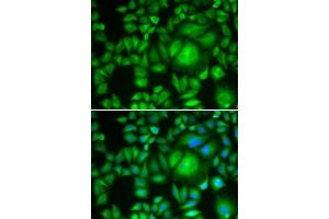 Immunofluorescence analysis of A-549 cells using CBR1 antibody. (CBR1 antibody  (AA 1-277))