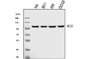 Western blot analysis of MSH2 using anti-MSH2 antibody (ABIN7601369).