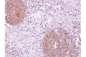IHC-P Image Immunohistochemical analysis of paraffin-embedded SAS xenograft, using KHS, antibody at 1:100 dilution. (MAP4K5 antibody)