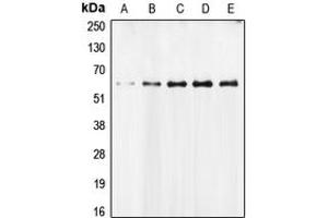 Western blot analysis of AIFM1 expression in MCF7 (A), Molt (B), Jurkat (C), mouse liver (D), rat heart (E) whole cell lysates. (AIF antibody  (N-Term))