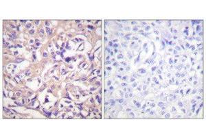 Immunohistochemistry (IHC) image for anti-TK (N-Term), (Ser13) antibody (ABIN1847976) (TK (N-Term), (Ser13) antibody)