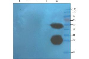 Western Blot using anti-TNF alpha antibody  Mouse liver (lane 1), mouse spinal cord (lane 2), mouse testis (lane 3), mouse colon (lane 4) and human thyroid tumour (lane 5) samples were resolved on a 10% SDS PAGE gel and blots probed with  at 1. (Recombinant TNF alpha (Infliximab Biosimilar) antibody)