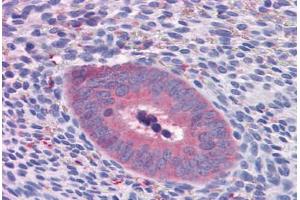 Human Uterus: Formalin-Fixed, Paraffin-Embedded (FFPE) (GART antibody  (AA 1-434))