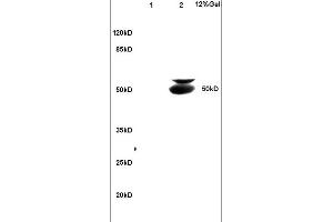 Lane 1: mouse brain lysates Lane 2: mouse intestine lysates probed with Anti BECN1/Beclin 1/ATG6 Polyclonal Antibody, Unconjugated (ABIN675384) at 1:200 in 4C.