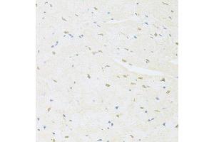 Immunohistochemistry of paraffin-embedded mouse heart using SAFB antibody.