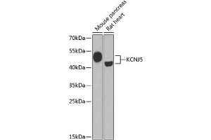 Western blot analysis of extracts of various cell lines, using KCNJ5 Antibody (ABIN6134098, ABIN6142740, ABIN6142741 and ABIN6221828) at 1:1000 dilution. (KCNJ5 antibody  (AA 50-150))