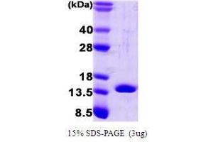 Figure annotation denotes ug of protein loaded and % gel used. (FABP4 Protein (AA 1-132))