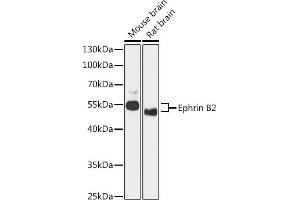 Western blot analysis of extracts of various cell lines, using Ephrin B2 antibody  at 1:1000 dilution. (Ephrin B2 antibody)