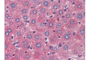 Mouse Liver (formalin-fixed, paraffin-embedded) stained with TSLPfollowed by biotinylated goat anti-rabbit IgG secondary antibody, alkaline phosphatase-streptavidin and chromogen. (Thymic Stromal Lymphopoietin antibody)