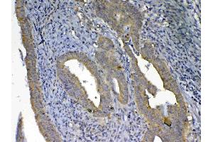 IHC analysis of UGT1A1 using anti-UGT1A1 antibody . (UGT1A1 antibody  (AA 316-533))