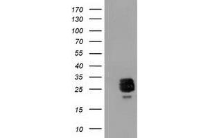 HEK293T cells were transfected with the pCMV6-ENTRY control (Left lane) or pCMV6-ENTRY CLPP (Right lane) cDNA for 48 hrs and lysed. (CLPP antibody)