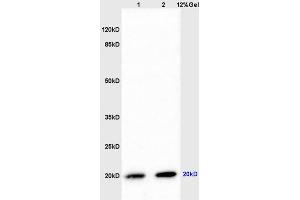 SDS-PAGE (SDS) image for anti-Parkinson Protein 7 (PARK7) (AA 101-189) antibody (ABIN674739)