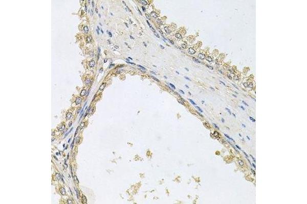 POMGNT1 antibody  (AA 411-660)