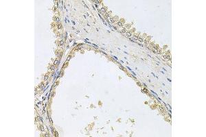 POMGNT1 anticorps  (AA 411-660)