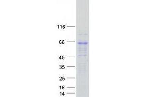 Validation with Western Blot