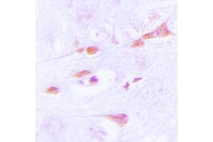 Immunohistochemical analysis of CaMK2 alpha/delta staining in human brain formalin fixed paraffin embedded tissue section. (CaMK2 alpha/delta antibody  (Center))
