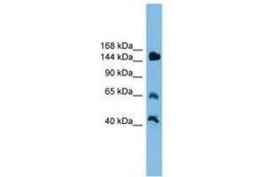 Image no. 1 for anti-Jumonji, AT Rich Interactive Domain 2 (JARID2) (AA 201-250) antibody (ABIN6744599) (JARID2 antibody  (AA 201-250))