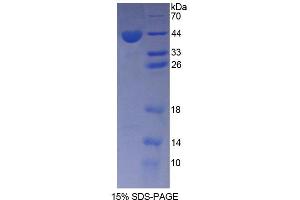 SDS-PAGE (SDS) image for Angiotensin II Receptor, Type 1 (AGTR1) (AA 263-359) protein (His tag,GST tag) (ABIN6239931)