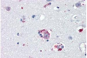 Anti-TAAR8 / TA5 antibody IHC staining of human brain, amygdala. (Trace Amine Associated Receptor 8 (TAAR8) (N-Term) antibody)
