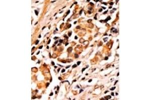 Image no. 2 for anti-BCL2-Associated Agonist of Cell Death (BAD) (pSer75) antibody (ABIN358086) (BAD antibody  (pSer75))