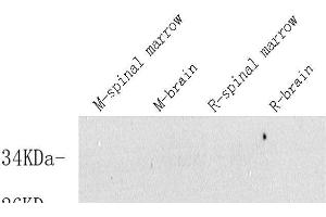 Western Blot analysis of various samples using VIP Polyclonal Antibody at dilution of 1:600. (Vip antibody)