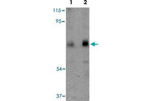 Western blot analysis of CAPN6 in rat lung tissue lysate with CAPN6 polyclonal antibody  at (Lane 1) 0. (Calpain 6 antibody  (C-Term))