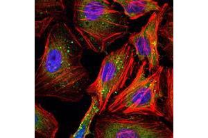 Immunofluorescence analysis of Hela cells using CCNB1 mouse mAb (green). (Cyclin B1 antibody)